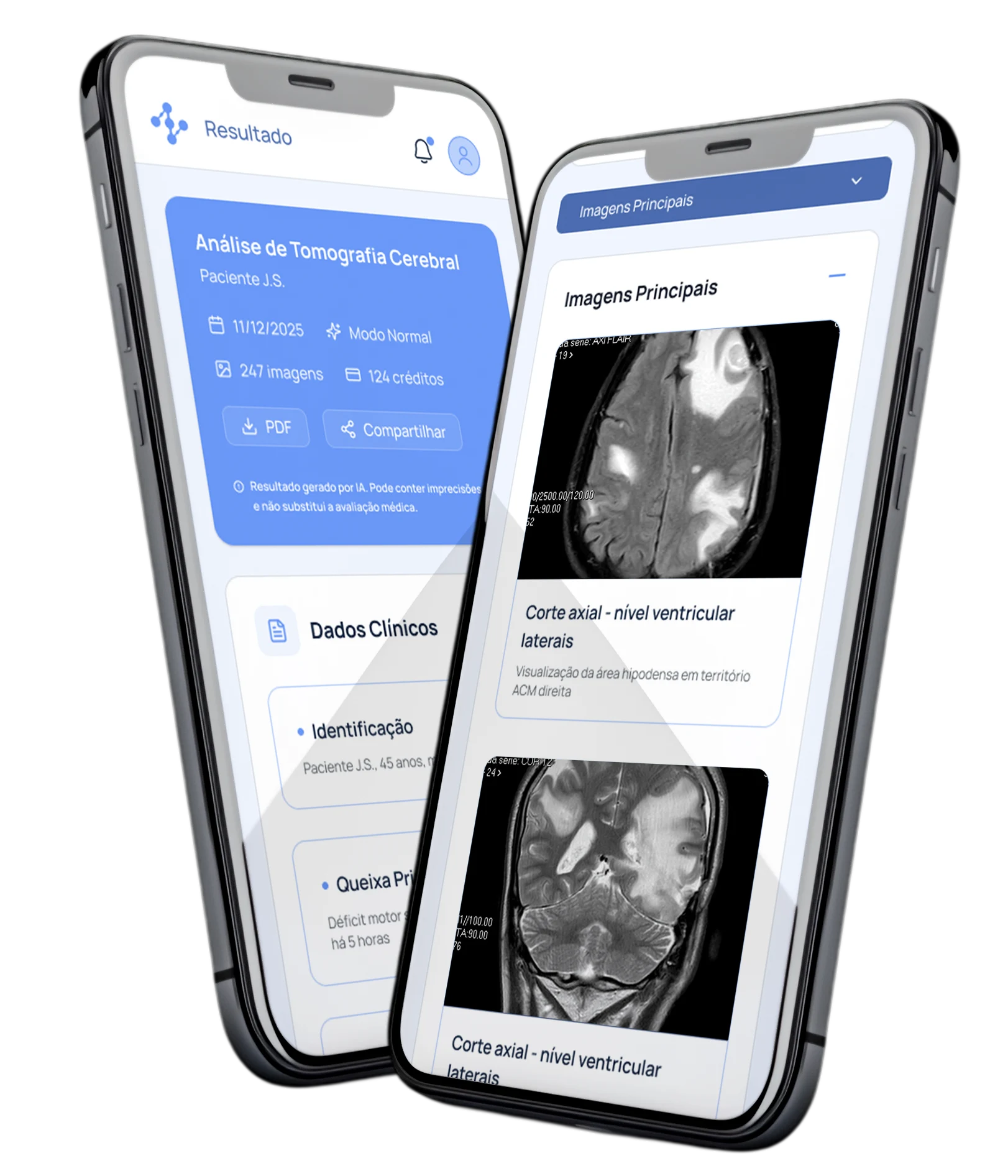 Tela de resultado de análise do Neurocalc com regiões críticas destacadas